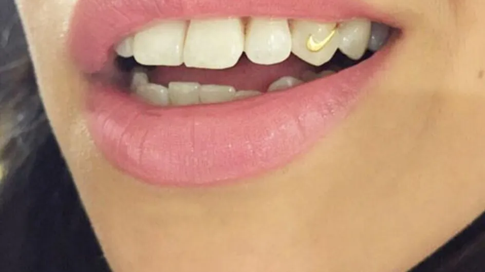 Jewellery For Your Teeth Is Coming Back In A Big Way