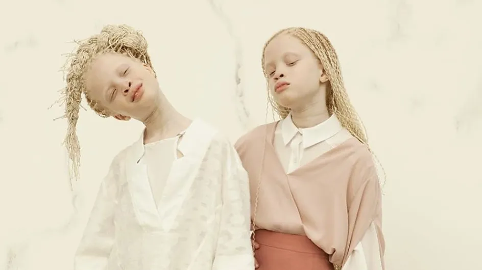 Ces jumelles albinos n'ont que 11 ans mais secouent déjà la fashion sphère (Photos)