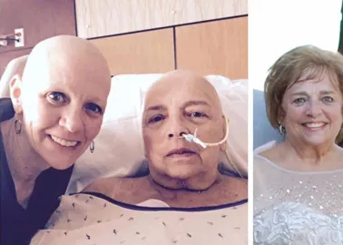 Forum frauen haarausfall