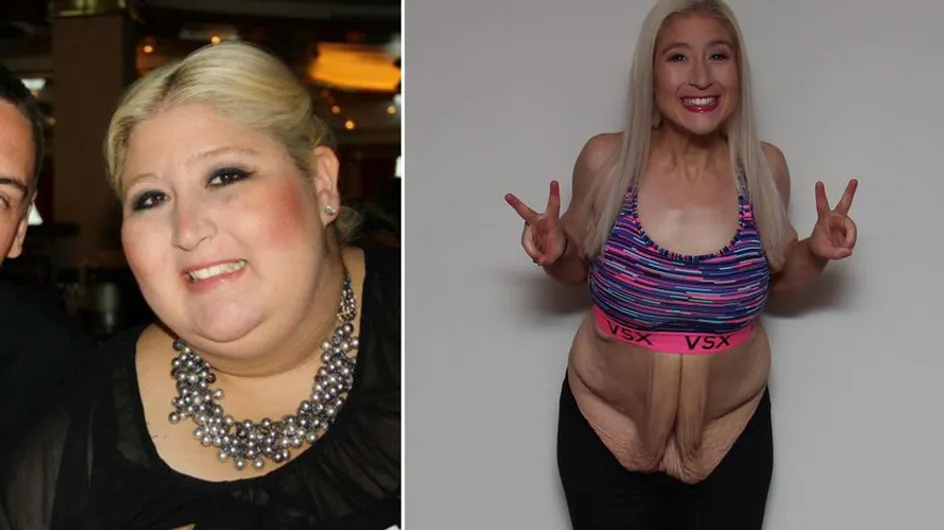 Diese Frau verlor fast 160 Kilo - und zeigt nun anderen, wie sie es geschafft hat!