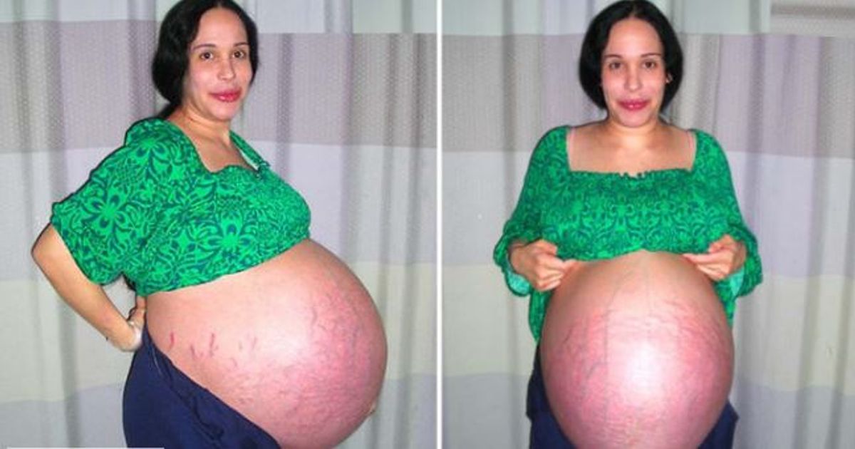Une femme accouche de 6 enfants en 26 mois - Bébés et Mamans