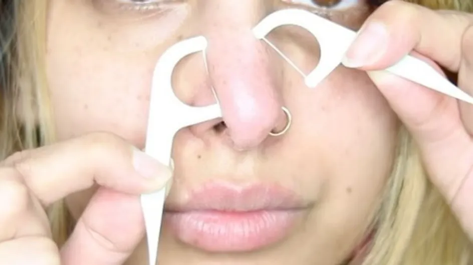 This Blogger Uses Dental Floss To Remove Blackheads And It's Surprisingly Effective