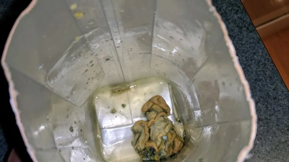 This Woman Found A "Squid Like" Object In Her Fancy Coconut Water