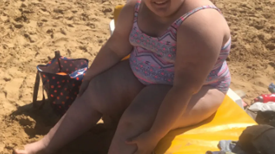 This Teenager Is Teaching Us A Valuable Lesson In Body Positivity After Facing Her Biggest Fear