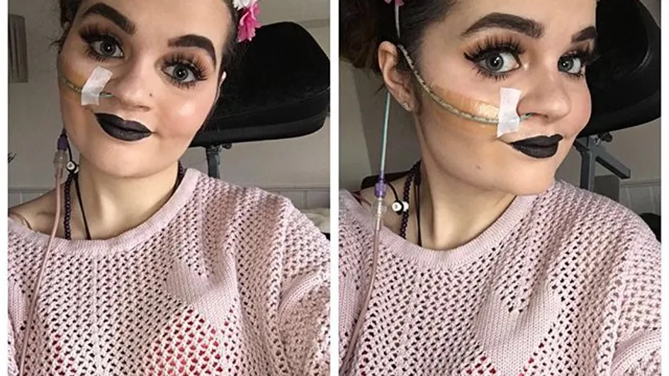 Grâce au maquillage, cette jeune malade a retrouvé confiance en elle (photos)