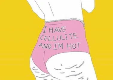 Can you get rid of cellulite completely? - LipoTherapeia