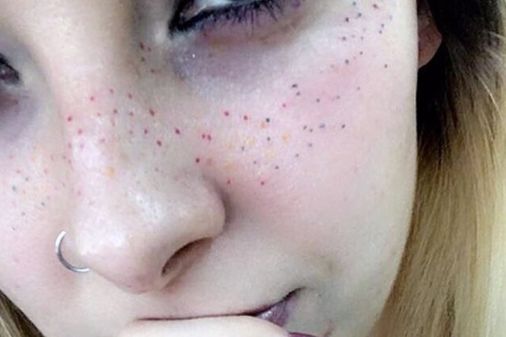 Rainbow freckles