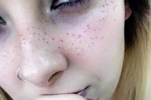 Rainbow freckles