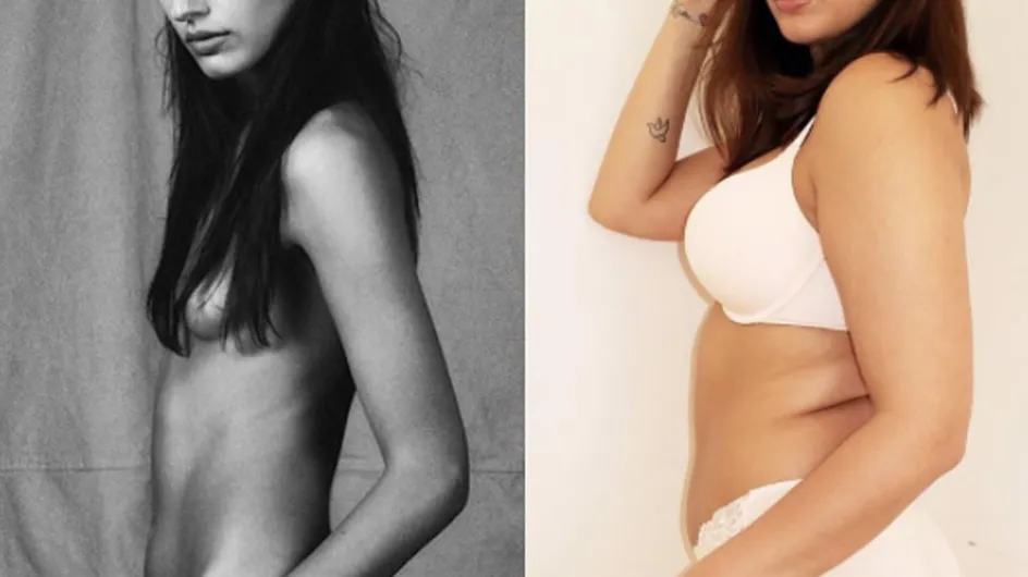 This Model Gave Up Living On '500 Calories A Day' To Embrace Her Natural Curves