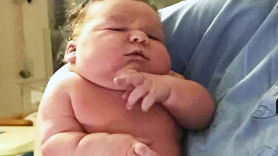 Un bebé estadounidense pesa 7,2 kilos al nacer