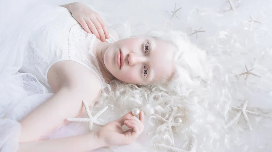 Cette photographe met en lumière la beauté hypnotisante des albinos (photos)