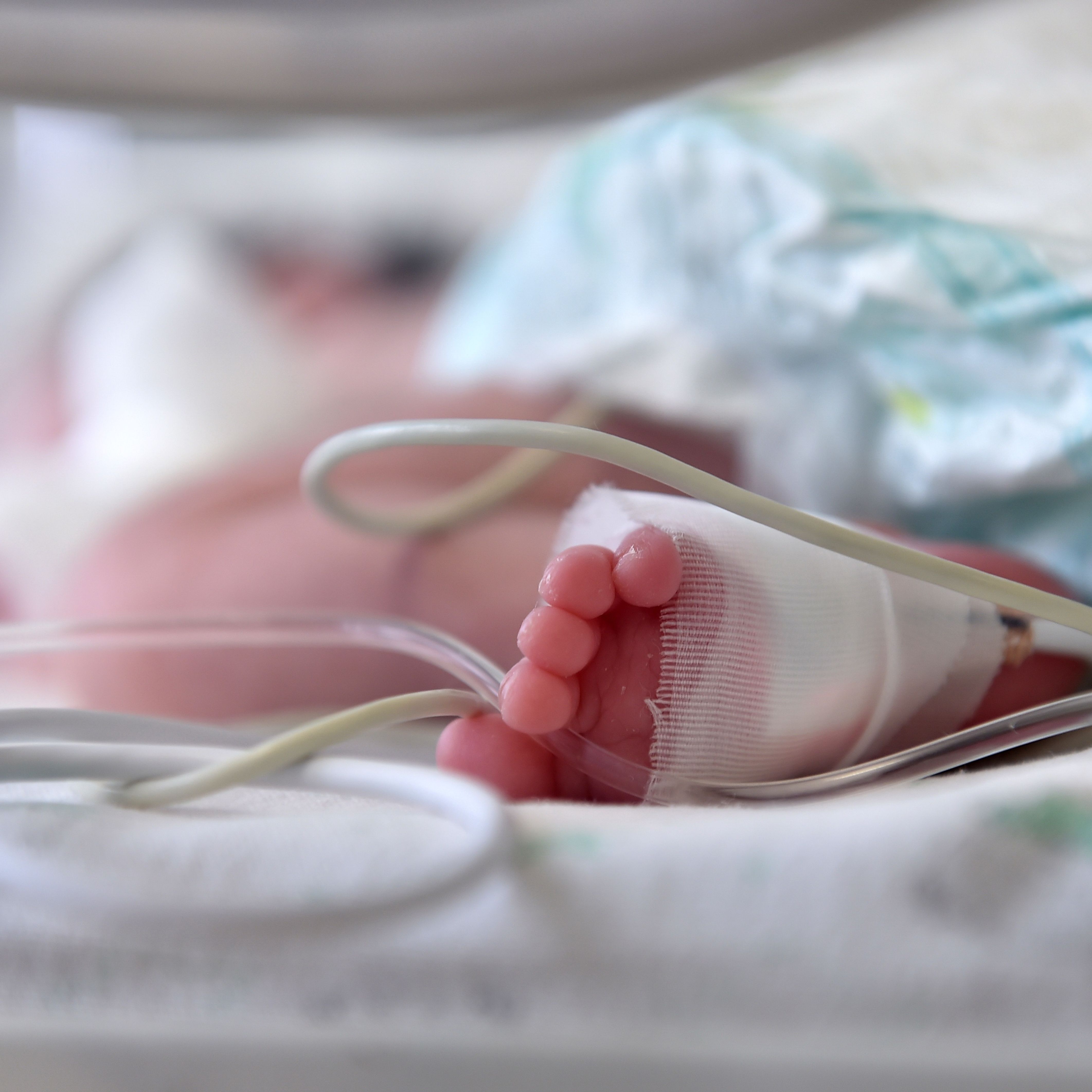 Prematurite Quels Types Causes Et Soins Pour Les Bebes Prematures