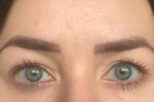 Brows