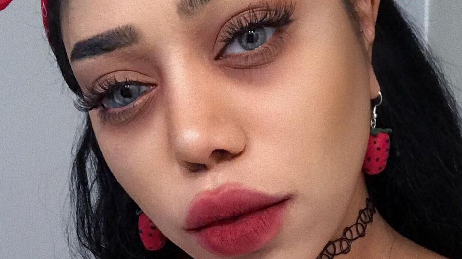 Cette Blogueuse Avec Une Tache De Naissance Demonte Les Critiques