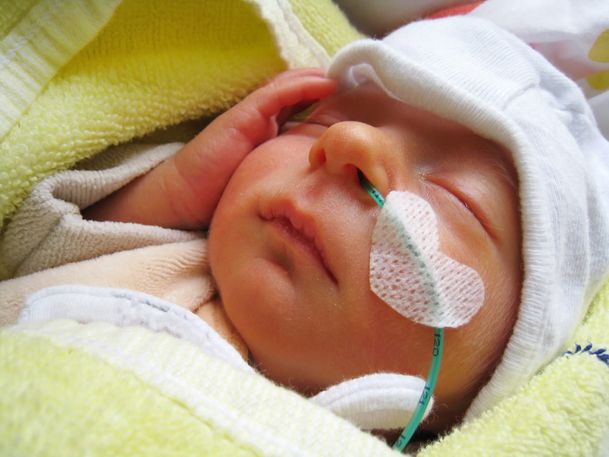 Mon Bebe Est Ne Premature Quels Risques Pour Lui