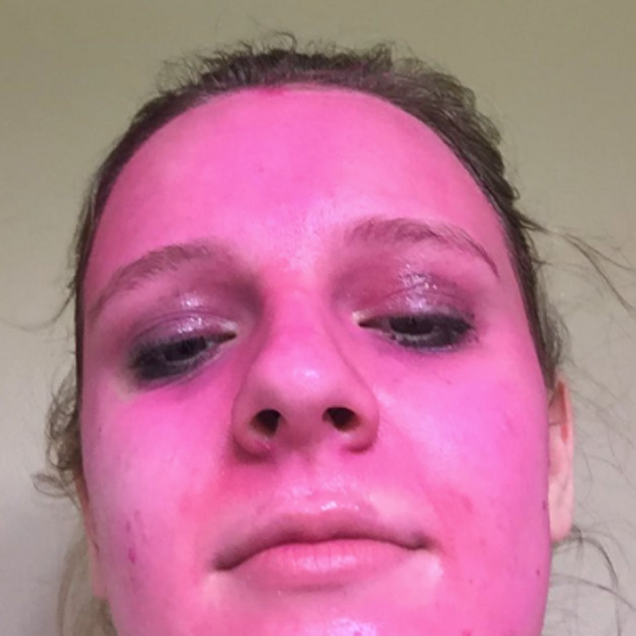 Woman Left Red-faced, Literally, After Using 'Washable' Glitter