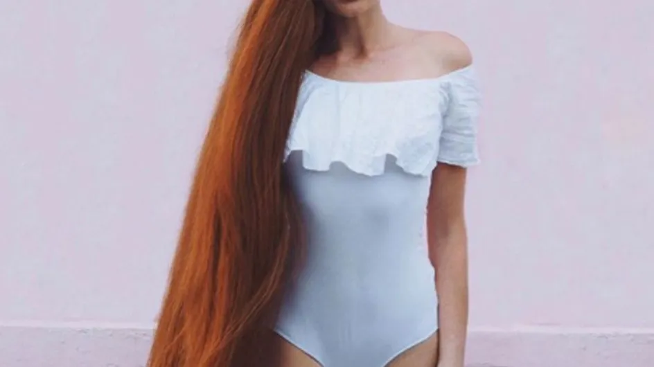 This Model Recovered From Severe Alopecia To Become Rapunzel IRL