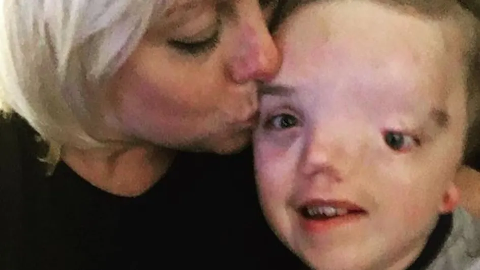 Instagram censura una foto de un niño enfermo y su madre responde así