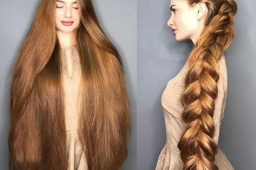 Anastasiya Sidorova atteinte d'alocépie.