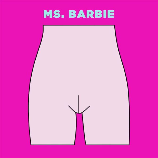Tipos de vulvas: Srta. Barbie