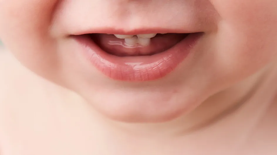 I primi dentini del bambino: sintomi, disturbi e tutto quello che c'è da sapere