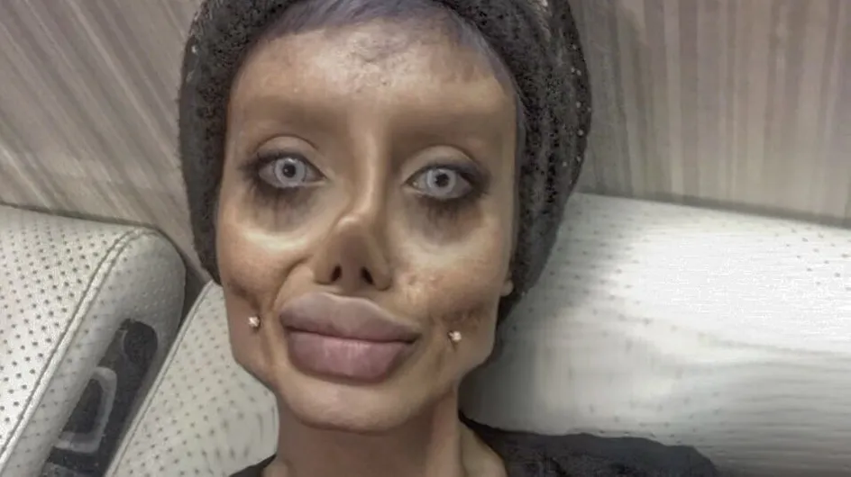 Esta chica se somete a 50 operaciones para parecerse a Angelina Jolie