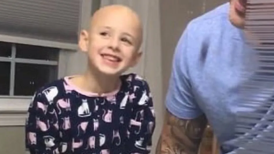 Ce papa se rase la tête pour soutenir sa petite fille atteinte d’alopécie