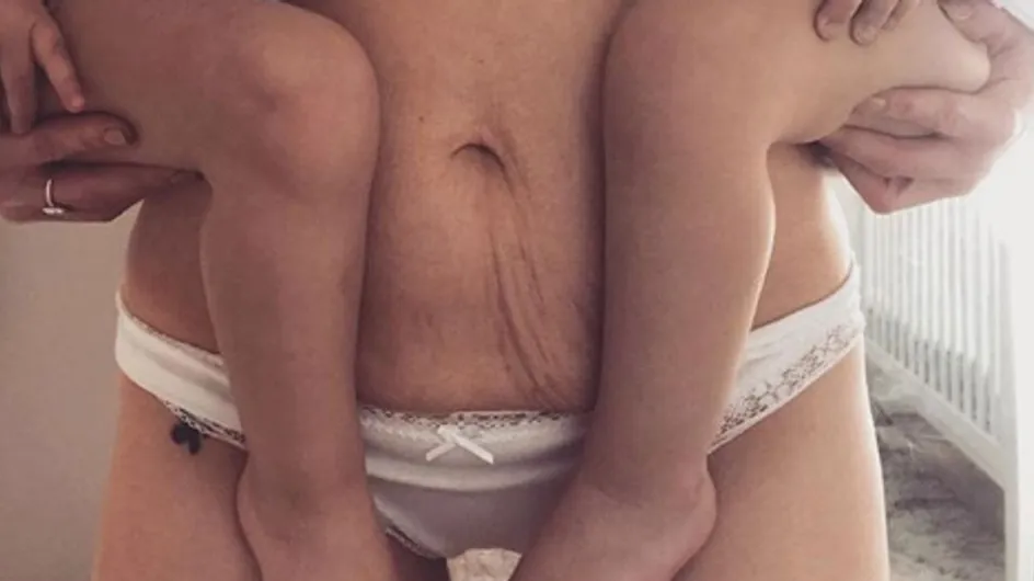 Voici à quoi ressemble vraiment le corps des femmes après l'accouchement (Photos)