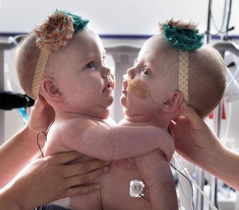 J Ai Mange Ma Jumelle In Utero Cette Femme A Deux Adn Elle Explique Ce Phenomene Rare J Ai Mange Ma Jumelle In Utero Cette Femme A Deux Adn Elle Explique Ce Phenomene Rare