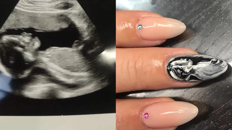 La manucure "échographie", la plus belle façon d'annoncer sa grossesse