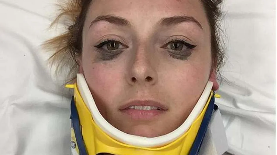 Elle poste un avis sur son eye-liner après son accident de voiture et déchaîne la Toile ! (Photos)