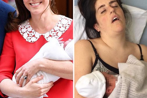 Comparación post-parto
