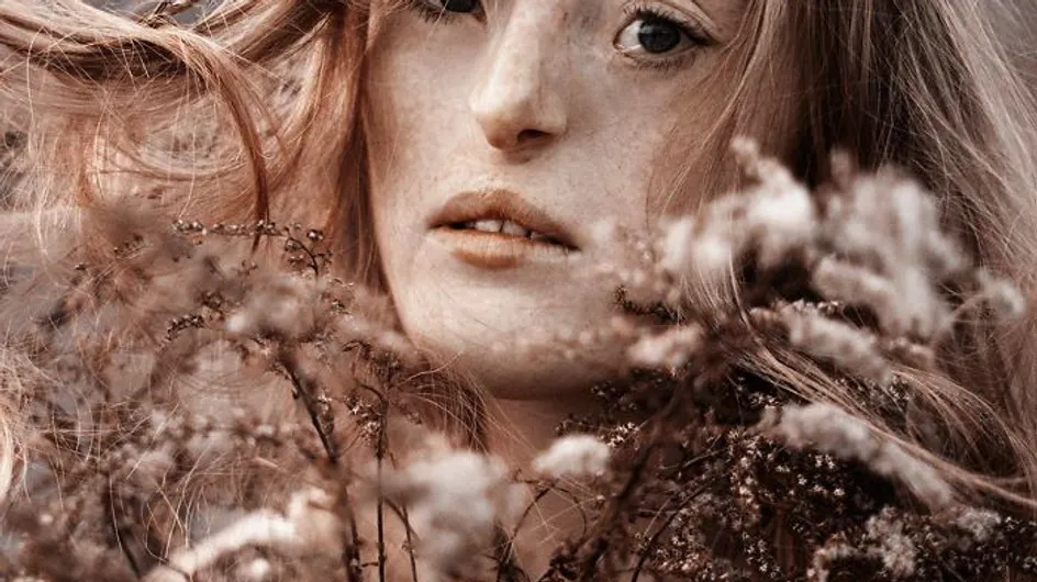 Ilka Brühl, la modelo con un raro defecto facial que rompe el ideal de belleza