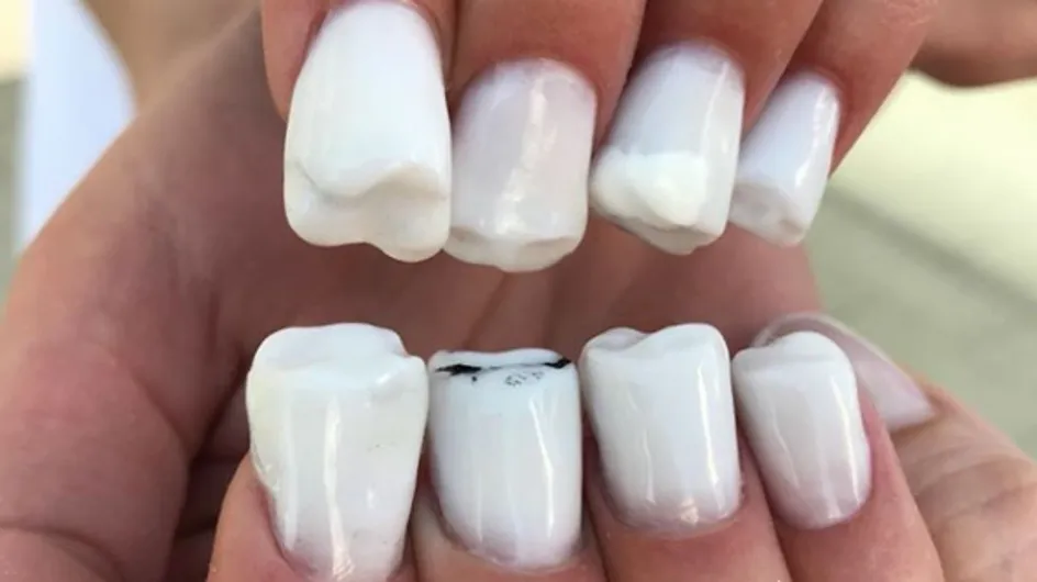 Molar Nails, la tendance nail art complètement WTF qui va vous faire grincer des dents