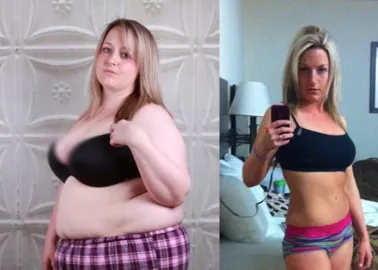 Avant/après : elle perd 65 kilos