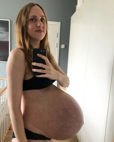 Cette maman enceinte de triplés montre son impressionnant baby bump
