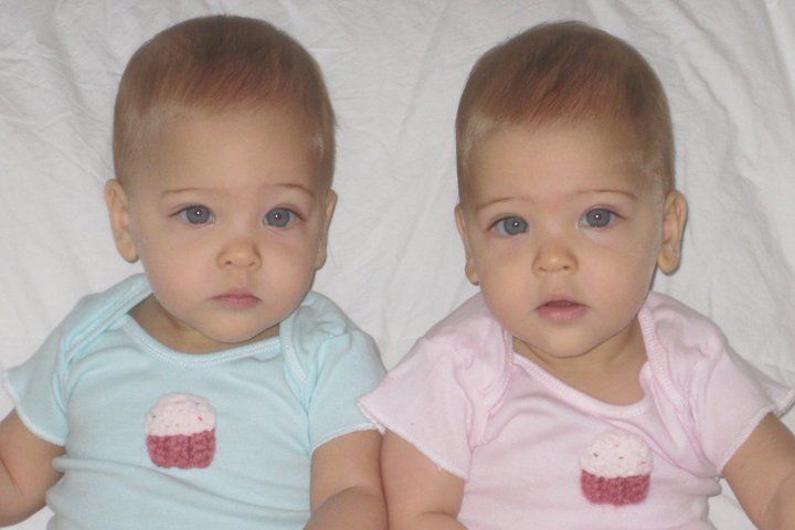 Jumelles Les Plus Belles Du Monde A Quoi Ressemblent Elles