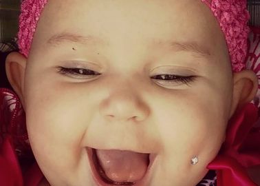 Etats Unis Cette Photo De Bebe Perce A La Joue Fait Scandale