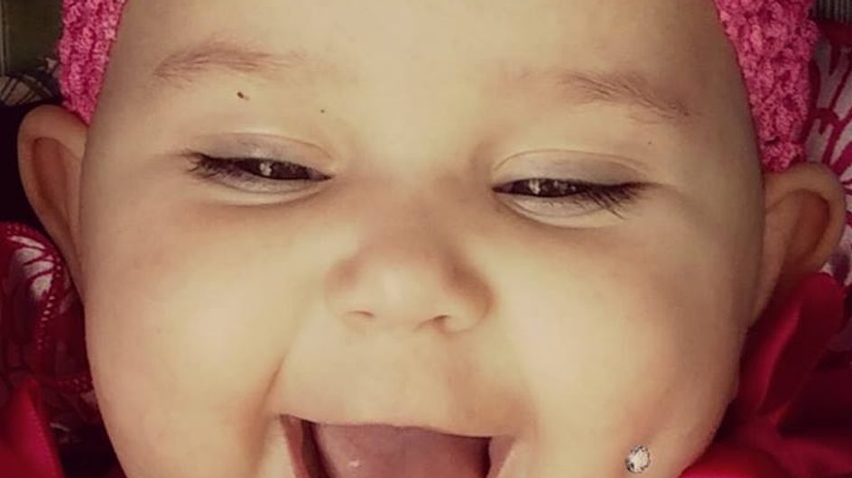 Etats Unis Cette Photo De Bebe Perce A La Joue Fait Scandale