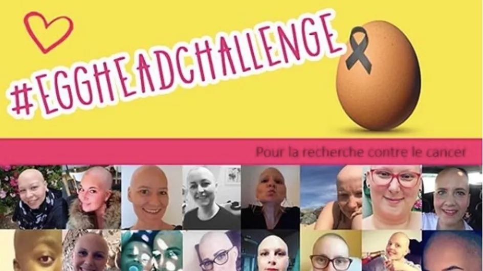 #EggHeadChallenge : atteintes d’un cancer, elles dévoilent leur "crâne d’œuf" pour la bonne cause (photos)