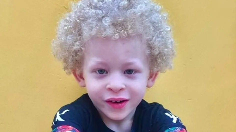 Grâce à Facebook, ce petit garçon albinos devient égérie Primark