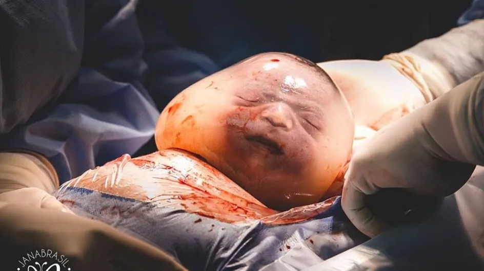 Les photos de ce bébé né dans une "bulle" sont vraiment impressionnantes