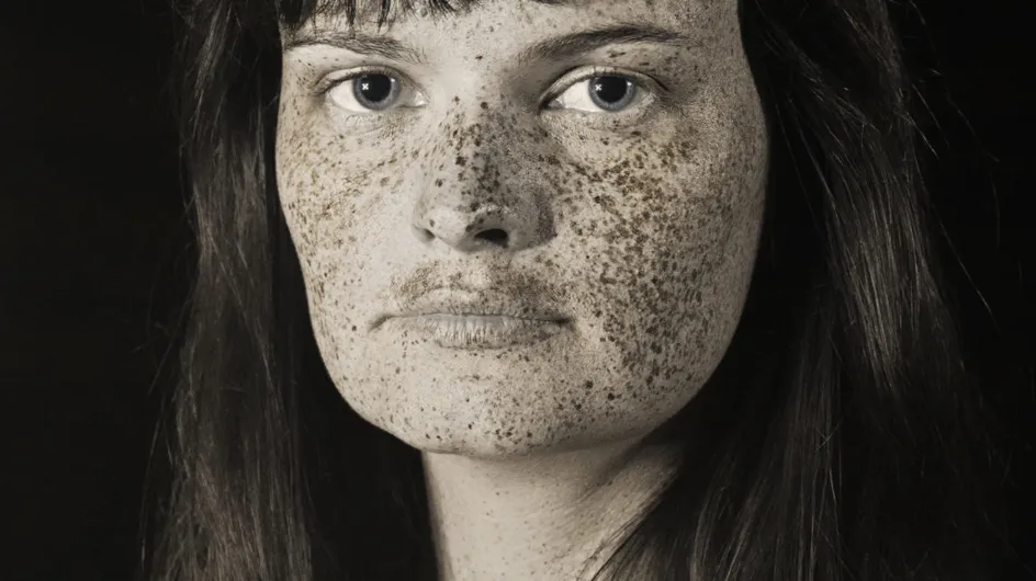 Un photographe montre l'impact inquiétant du soleil sur notre peau (Photos)