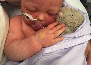 Elle Sensibilise A La Vaccination Avec Ces Photos De Son Bebe Malade