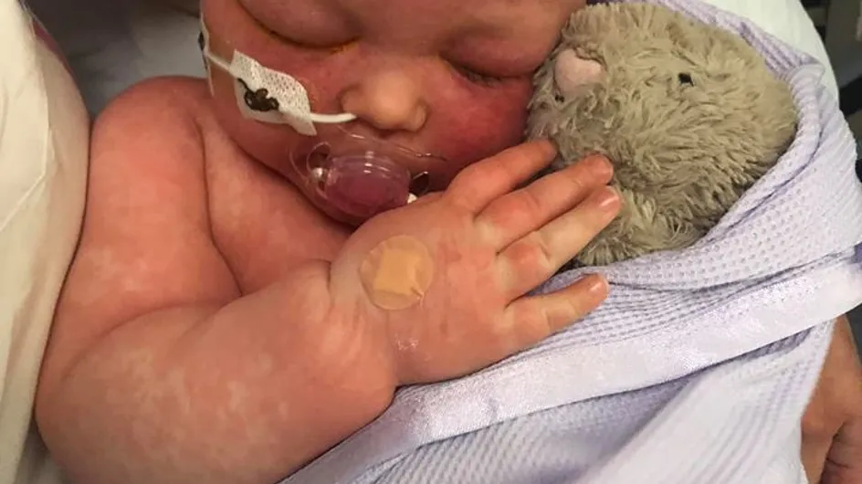 Elle publie les photos choquantes de son bébé pour alerter sur la non-vaccination