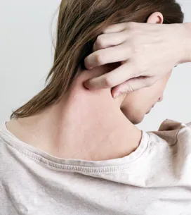 ¿Tienes la piel atópica? Estos son los productos imprescindibles para tratarla