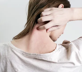 ¿Tienes la piel atópica? Estos son los productos imprescindibles para tratarla