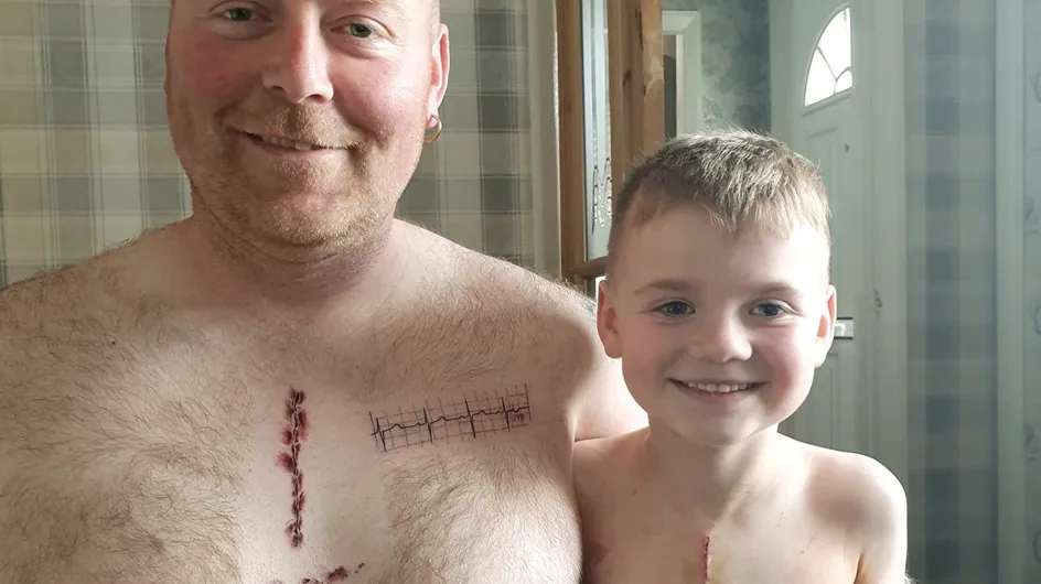 Ce papa se fait tatouer la même cicatrice que son petit garçon opéré du coeur