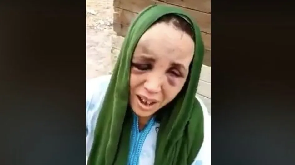 Victime de violences conjugales, cette Marocaine raconte son calvaire