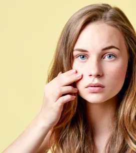 4 trucos de maquillaje para cubrir impurezas y granitos del rostro